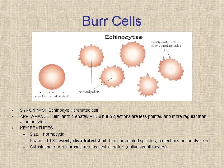 Burr Cells • • • SYNONYMS: Echinocyte , crenated cell APPEARANCE: Similar to crenated