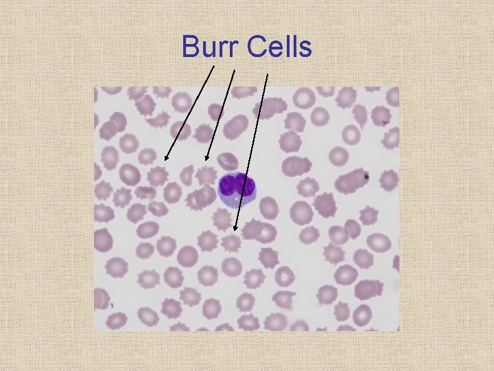 Burr Cells 