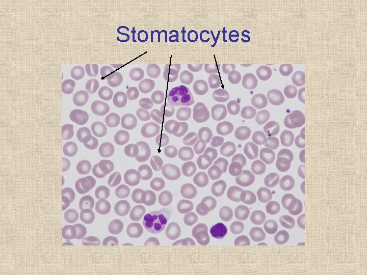 Stomatocytes 