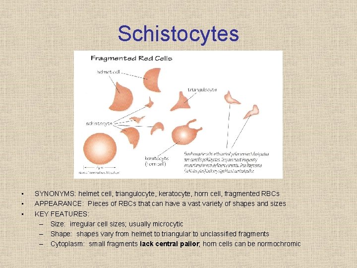 Schistocytes • • • SYNONYMS: helmet cell, triangulocyte, keratocyte, horn cell, fragmented RBCs APPEARANCE: