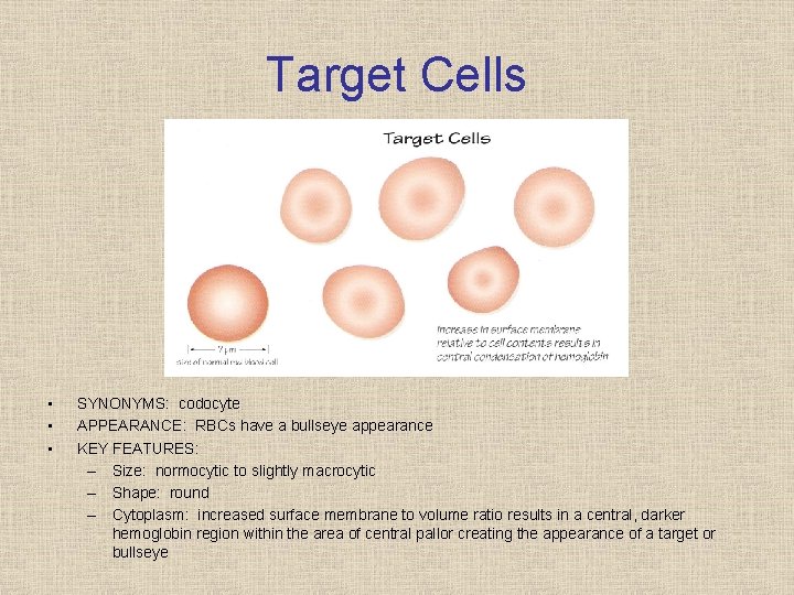 Target Cells • • • SYNONYMS: codocyte APPEARANCE: RBCs have a bullseye appearance KEY