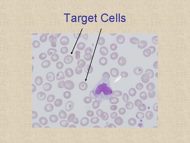 Target Cells 