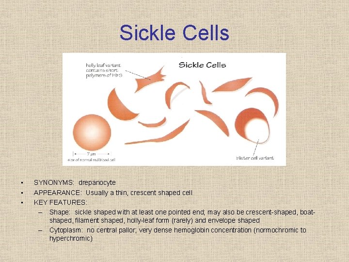 Sickle Cells • • • SYNONYMS: drepanocyte APPEARANCE: Usually a thin, crescent shaped cell