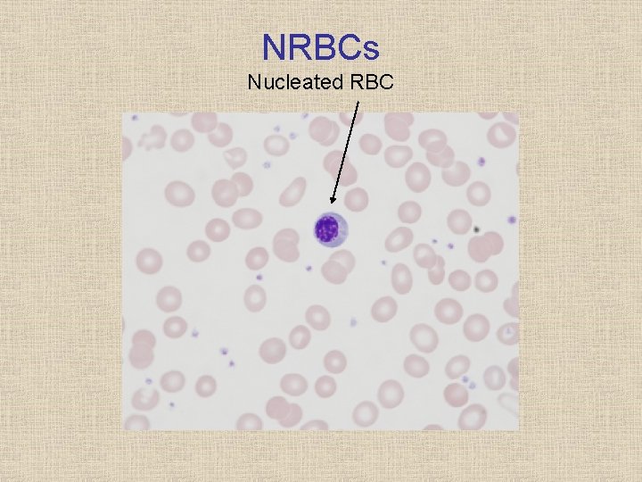 NRBCs Nucleated RBC 