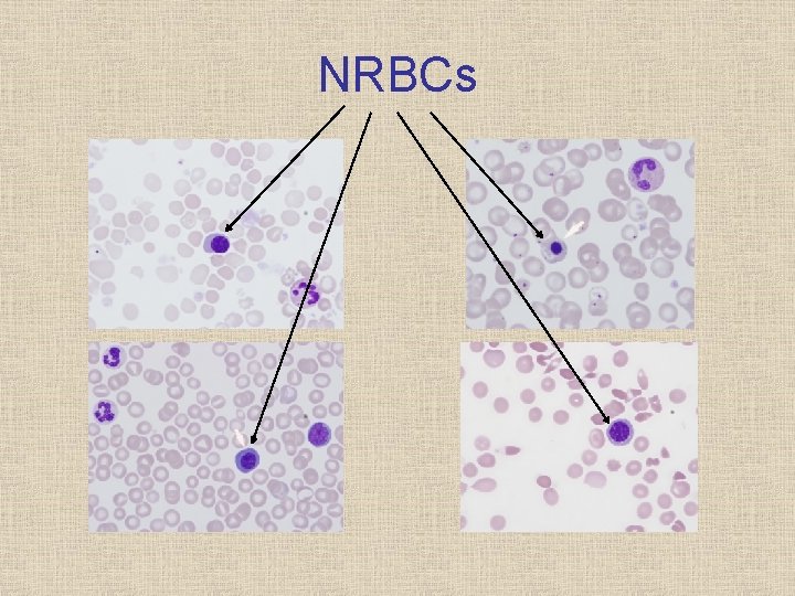 NRBCs 