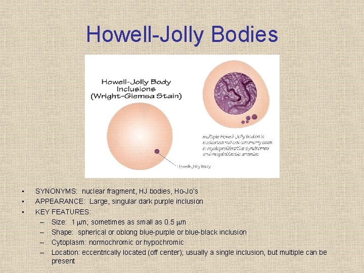 Howell Jolly Bodies • • • SYNONYMS: nuclear fragment, HJ bodies, Ho Jo’s APPEARANCE:
