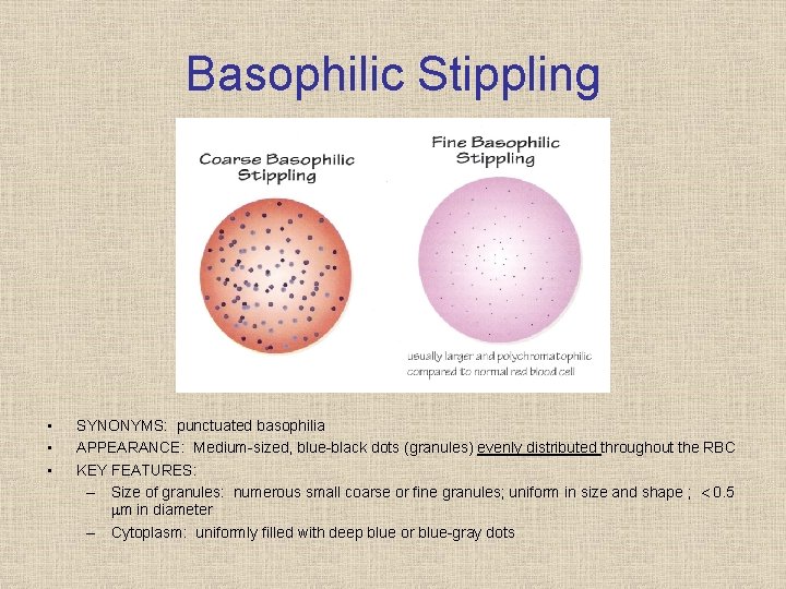 Basophilic Stippling • • • SYNONYMS: punctuated basophilia APPEARANCE: Medium sized, blue black dots