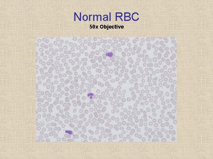 Normal RBC 50 x Objective 