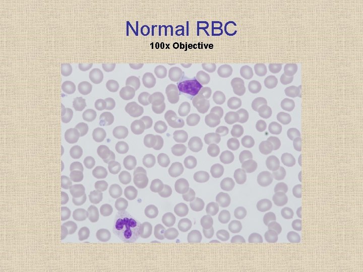 Normal RBC 100 x Objective 