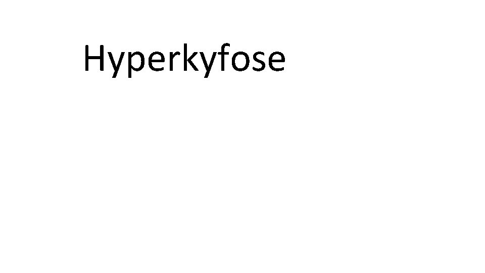 Hyperkyfose 