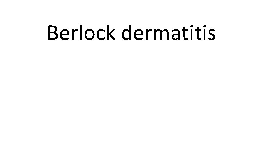 Berlock dermatitis 