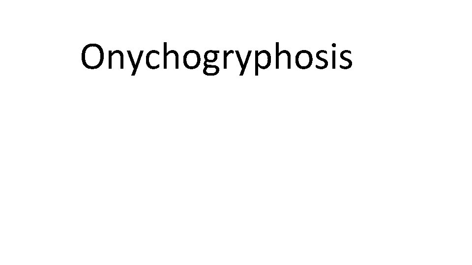 Onychogryphosis 