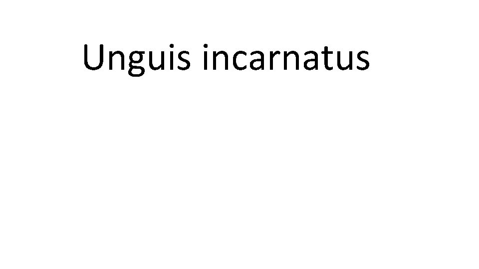 Unguis incarnatus 