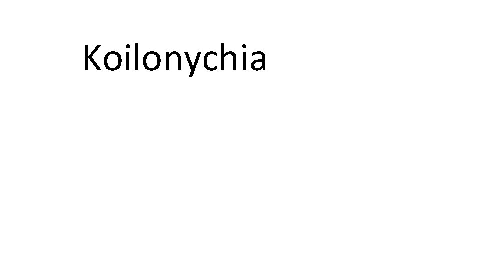 Koilonychia 