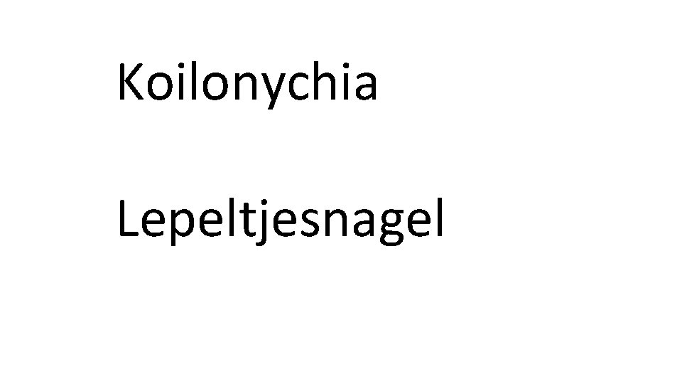 Koilonychia Lepeltjesnagel 