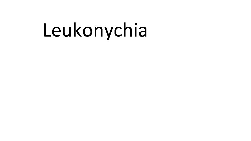 Leukonychia 