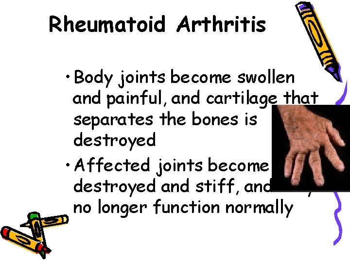 Rheumatoid Arthritis • Body joints become swollen and painful, and cartilage that separates the