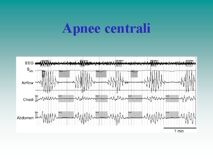 Apnee centrali 