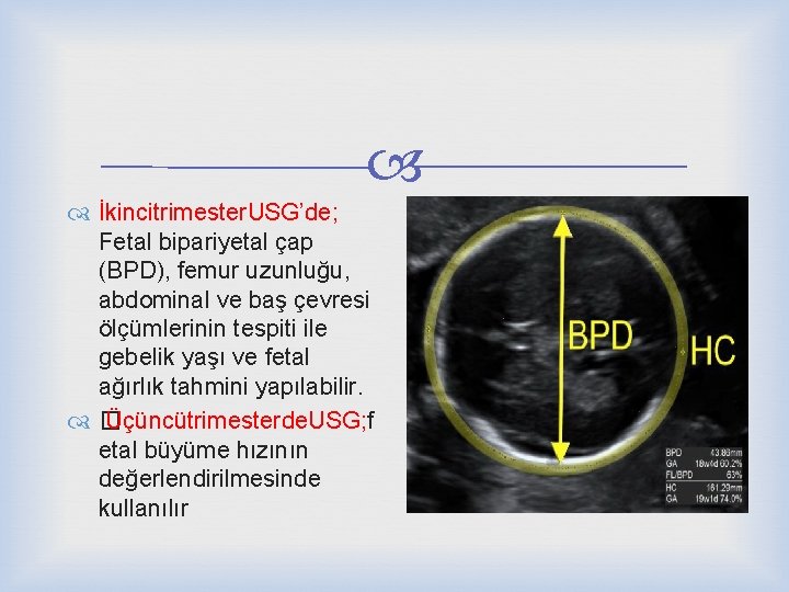  İkincitrimester. USG’de; Fetal bipariyetal çap (BPD), femur uzunluğu, abdominal ve baş çevresi ölçümlerinin