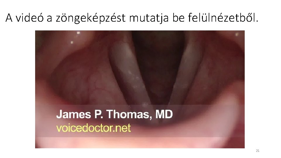 A videó a zöngeképzést mutatja be felülnézetből. 21 