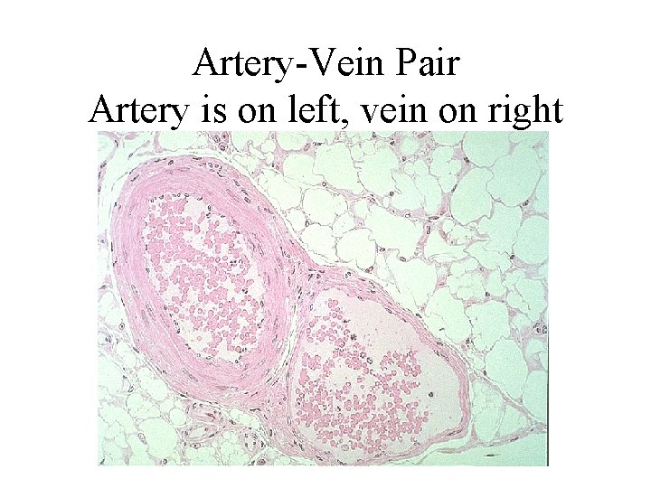 Artery-Vein Pair Artery is on left, vein on right 