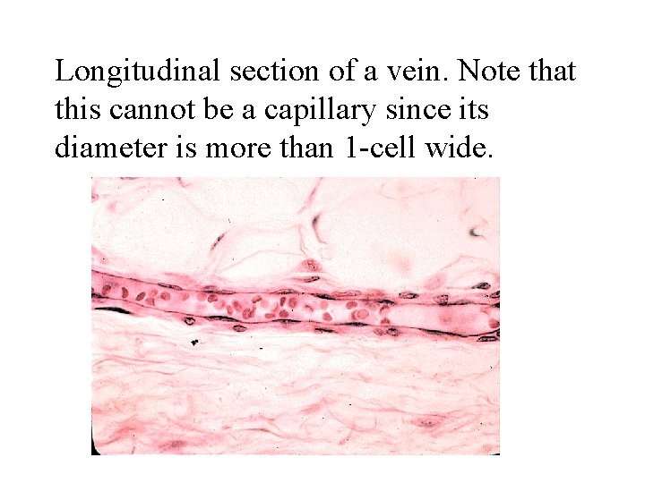 Longitudinal section of a vein. Note that this cannot be a capillary since its