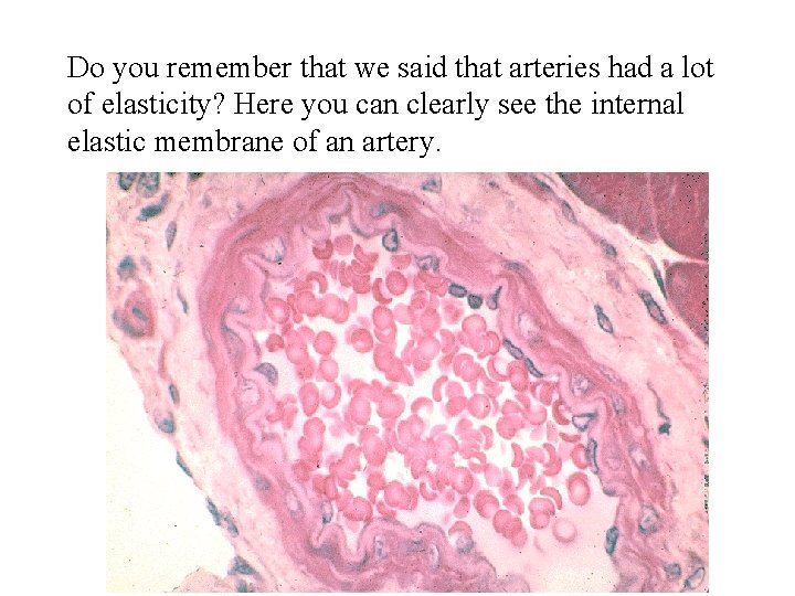 Do you remember that we said that arteries had a lot of elasticity? Here