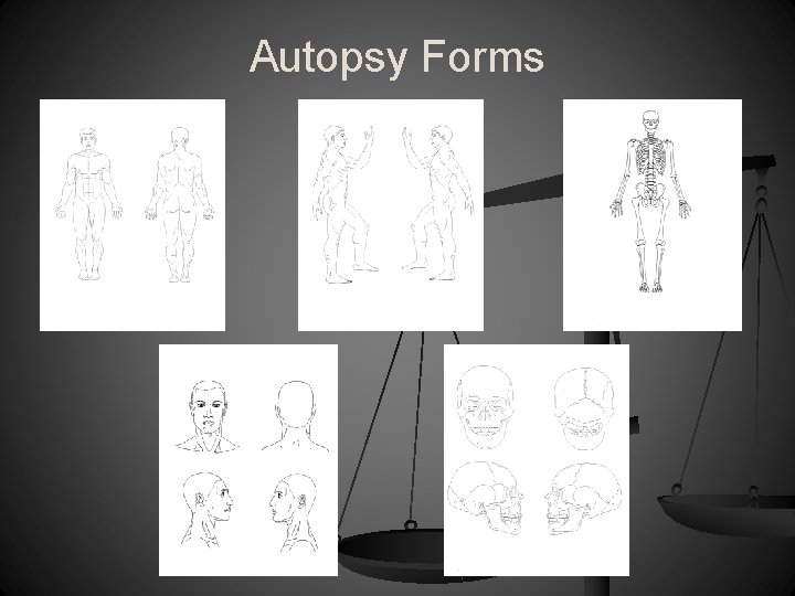 Autopsy Forms 