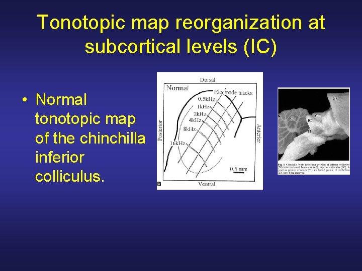 Tonotopic map reorganization at subcortical levels (IC) • Normal tonotopic map of the chinchilla