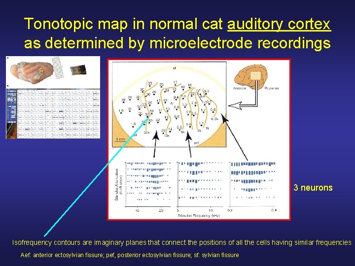 Tonotopic map in normal cat auditory cortex as determined by microelectrode recordings 3 neurons