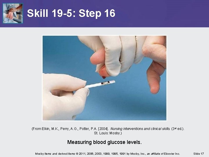 Skill 19 -5: Step 16 (From Elkin, M. K. , Perry, A. G. ,