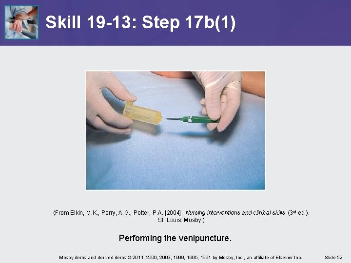 Skill 19 -13: Step 17 b(1) (From Elkin, M. K. , Perry, A. G.