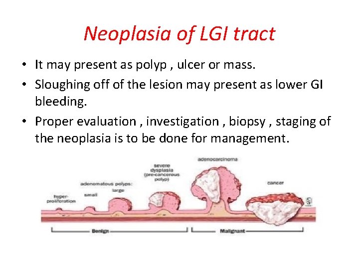 Neoplasia of LGI tract • It may present as polyp , ulcer or mass.