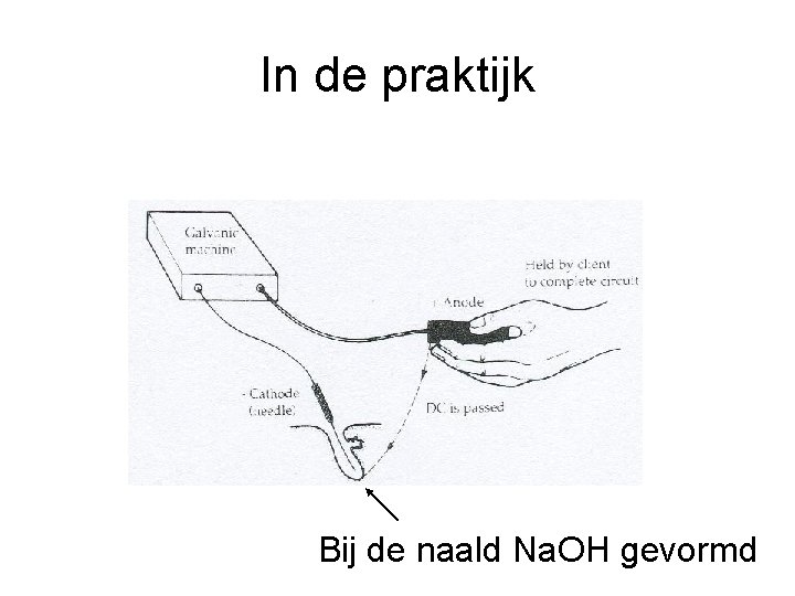 In de praktijk Bij de naald Na. OH gevormd 