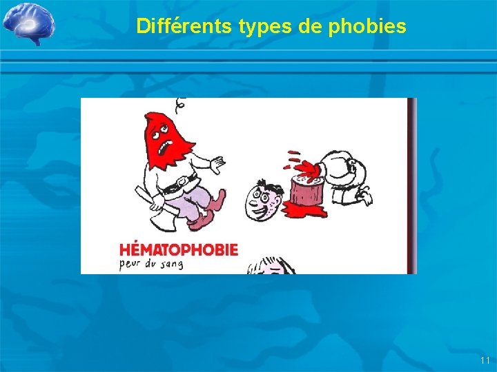 Différents types de phobies 11 