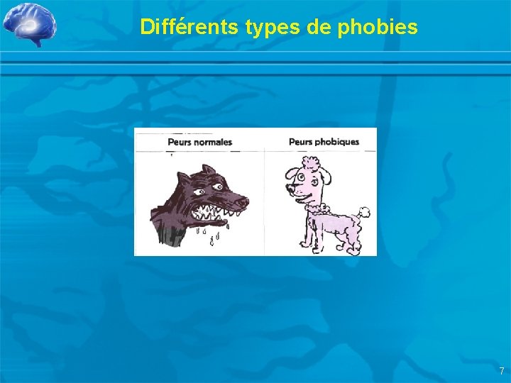 Différents types de phobies 7 