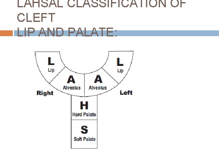 LAHSAL CLASSIFICATION OF CLEFT LIP AND PALATE: 