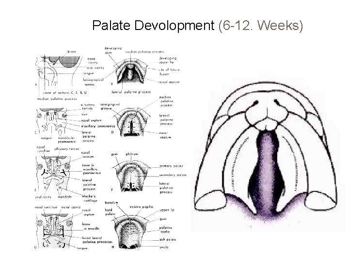 Palate Devolopment (6 -12. Weeks) 