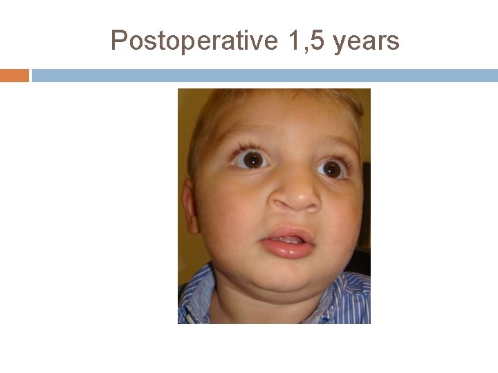 Postoperative 1, 5 years 