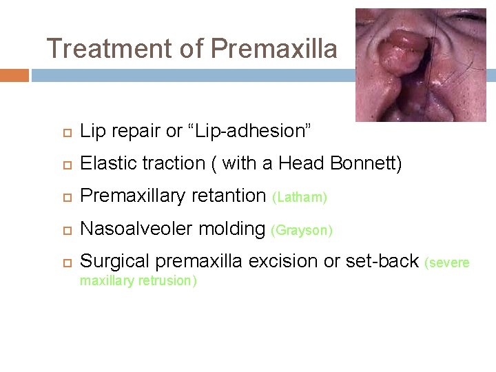 Treatment of Premaxilla Lip repair or “Lip-adhesion” Elastic traction ( with a Head Bonnett)