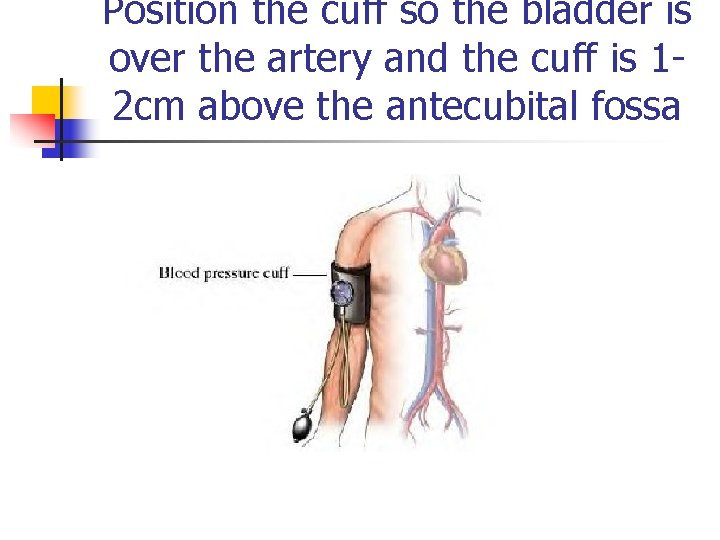 Position the cuff so the bladder is over the artery and the cuff is