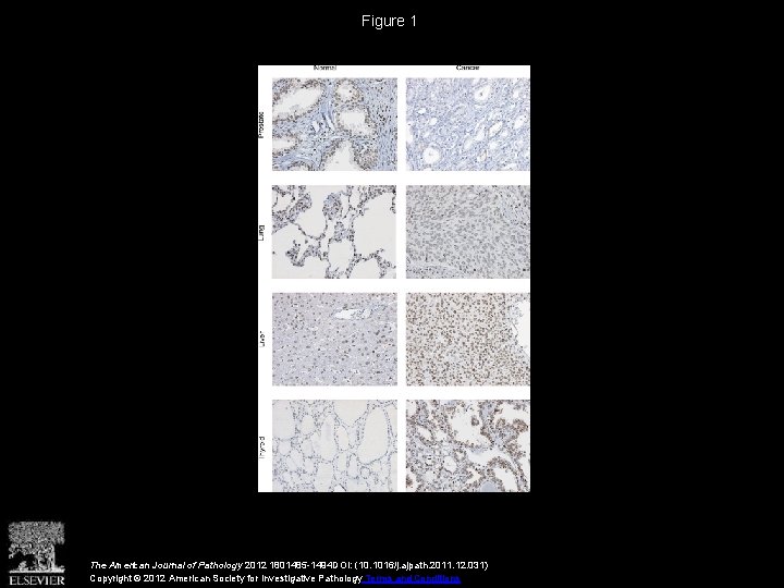 Figure 1 The American Journal of Pathology 2012 1801485 -1494 DOI: (10. 1016/j. ajpath.