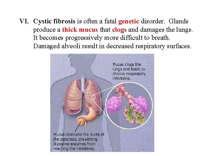 VI. Cystic fibrosis is often a fatal genetic disorder. Glands produce a thick mucus