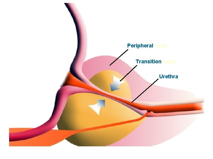 Peripheral zone Transition zone Urethra 29 
