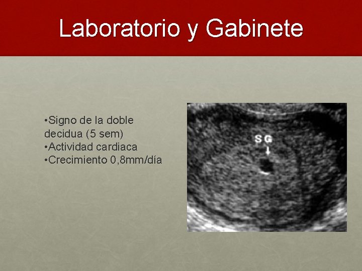 Laboratorio y Gabinete • Signo de la doble decidua (5 sem) • Actividad cardiaca