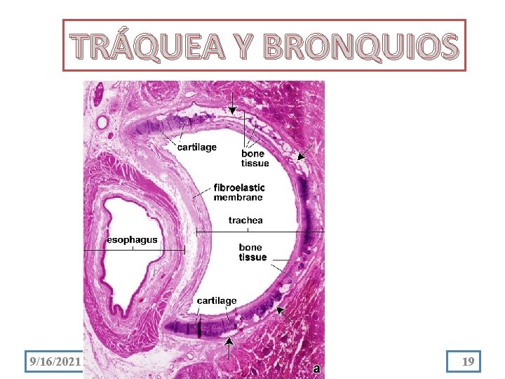 TRÁQUEA Y BRONQUIOS 9/16/2021 19 