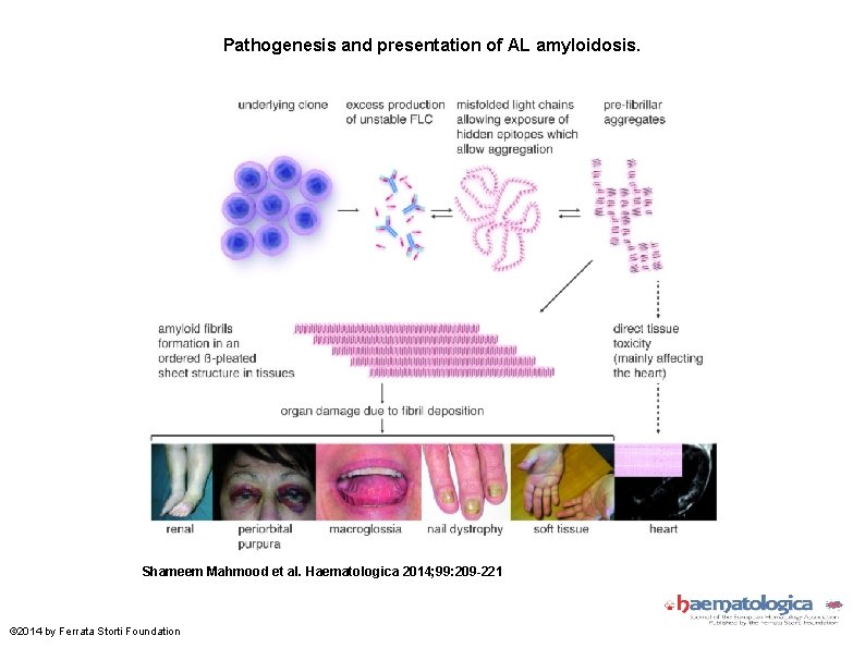 Pathogenesis and presentation of AL amyloidosis. Shameem Mahmood et al. Haematologica 2014; 99: 209