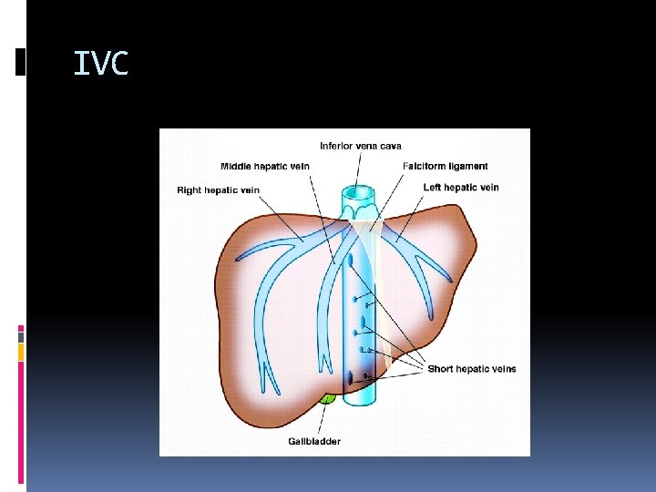 IVC 