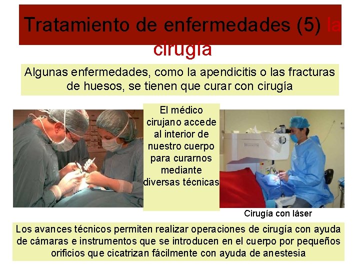 Tratamiento de enfermedades (5) la cirugía Algunas enfermedades, como la apendicitis o las fracturas