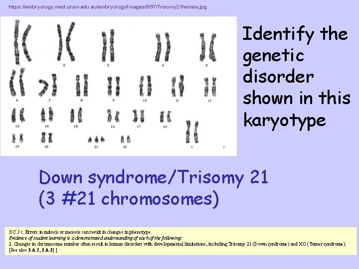 https: //embryology. med. unsw. edu. au/embryology/images/9/97/Trisomy 21 female. jpg Identify the genetic disorder shown